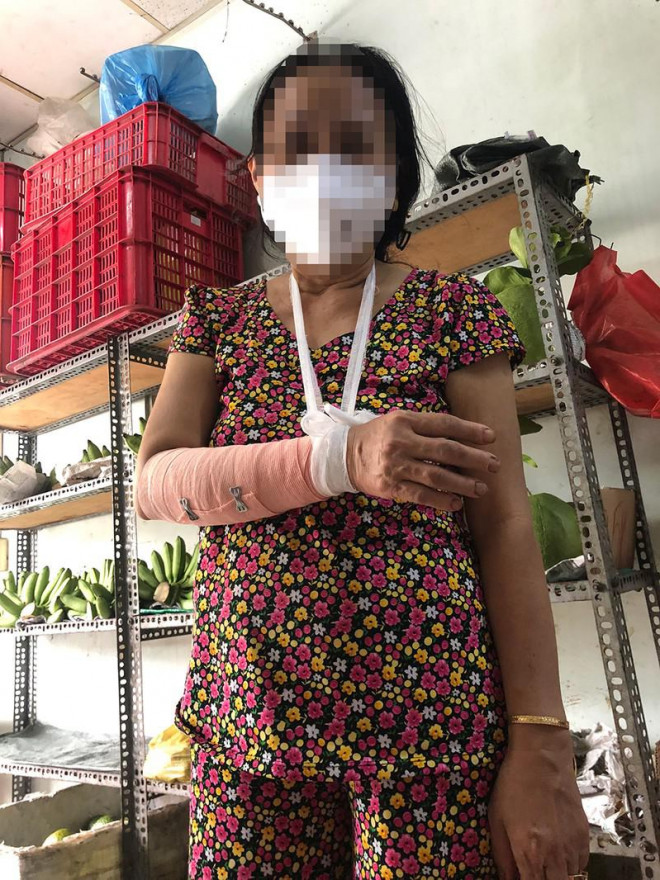 Bà NTV, chị ruột bà H. cũng được phản ánh là bị thương ở tay sau vụ việc. Ảnh: NVCC