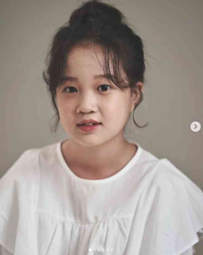 Kim Seol&nbsp;ngày nào đã lớn phổng phao, gương mặt trở nên sắc nét hơn.