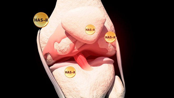 HAS II - Hoạt chất “vàng” giúp kiểm soát tốt bệnh thoát vị đĩa đệm