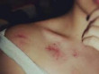Tội ác đằng sau vết cắn trên ngực trái của thiếu nữ: Cái chết khủng khiếp