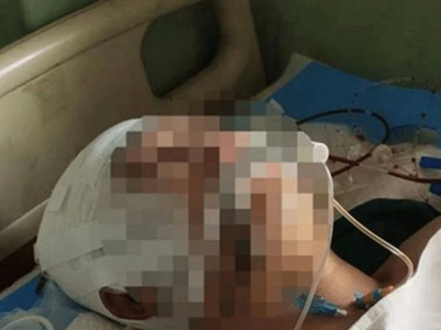 Giáo dục - du học - Hai thầy giáo đánh nam sinh 15 tuổi đến xuất huyết não