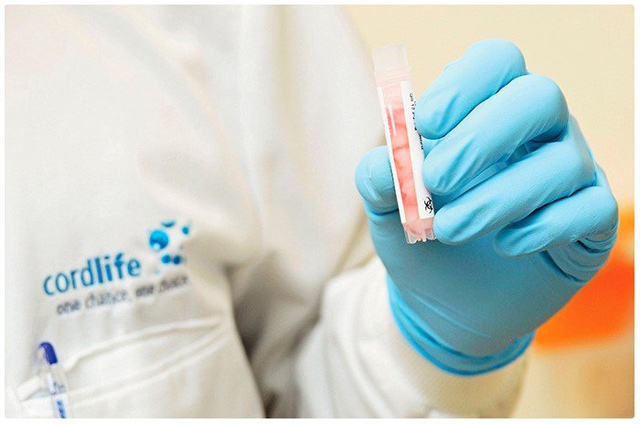 Tế bào gốc máu cuống rốn được thu thập ngay sau khi bé chào đời