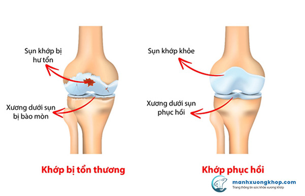 Đau trở người không được vì thoái hoá cột sống lâu năm - học ngay bí quyết cụ bà 70 tuổi - 3