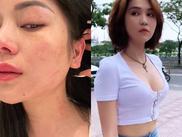 Đời sống Showbiz - “Ngọc nữ Bolero” đăng ảnh bị hành hung sau "lời qua tiếng lại" trên mạng