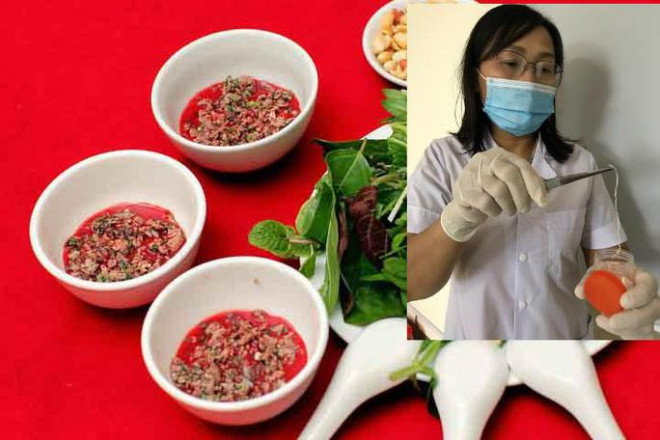 Thích ăn tiết canh, 1 nam giới lôi được giun dài từ đùi - 2