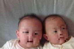 Phi thường - kỳ quặc - Hai bé trai song sinh trông quá khác nhau, kết quả xét nghiệm ADN vạch trần bí mật cay đắng