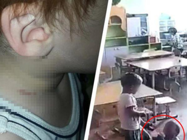 Giáo dục - du học - Nga: Con đi học về có vết thâm tím trên cổ, mẹ phát hiện chuyện kinh hoàng khi xem camera