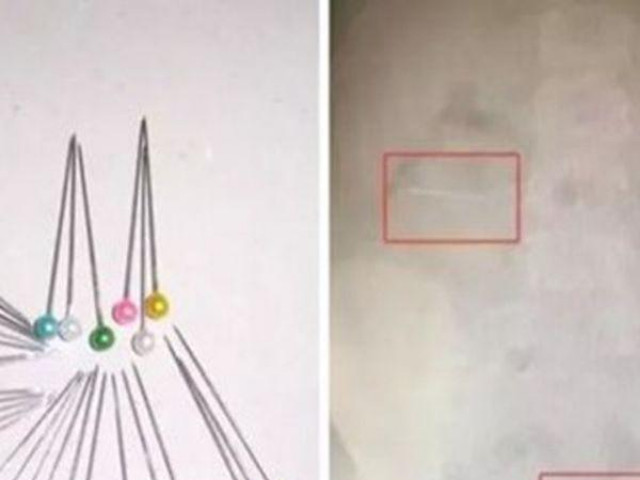 Giáo dục - du học - Con trai hào hứng khoe vừa làm ảo thuật trên lớp, mẹ nghe xong hoảng hồn đưa ngay đi viện