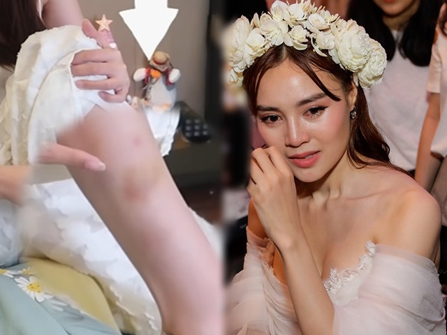 Giải trí - Ninh Dương Lan Ngọc "mếu máo" khoe chân bầm tím vì sao nam này
