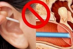Sức khỏe đời sống - Phát hiện khối u ác tính sau nhiều năm vệ sinh tai sai cách, chuyên gia cảnh báo từ bỏ ngay sai lầm này