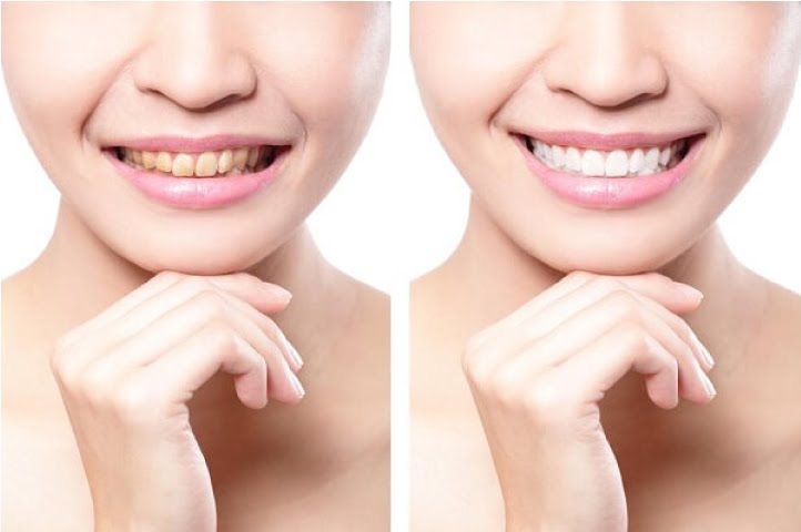 Bí quyết từ thiên nhiên giúp răng trắng bóng không cần kem đánh răng - 3
