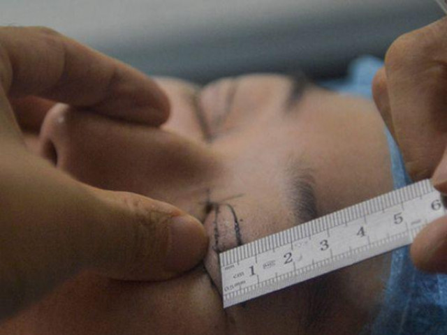 Phi thường - kỳ quặc - Vợ nghe lời đường mật đi thẩm mỹ để “đổi phong thủy cho chồng”, ngờ đâu phải trả cái giá quá đắt