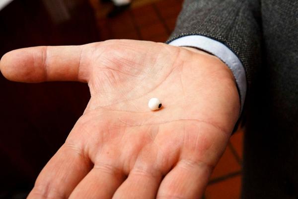 Chuyên gia cho biết viên ngọc trai có một vài khuyết điểm nhưng có thể can thiệp được, giá bán có thể lên tới 93 triệu đồng.