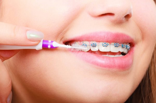 Bàn chải kẽ giúp loại đi thức ăn dư thừa