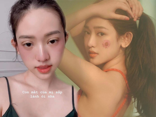 Làm đẹp - "Hot girl Cà Mau" Thúy Vi gây chú ý trên mạng xã hội vì đôi mắt sưng húp