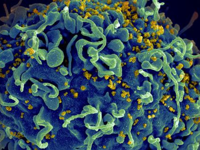 Thế giới - Kỳ diệu người phụ nữ tự loại bỏ HIV