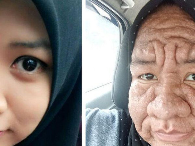 Phi thường - kỳ quặc - Người phụ nữ 28 tuổi bỗng hóa bà lão chỉ sau 1 đêm, nguyên nhân gây ngỡ ngàng