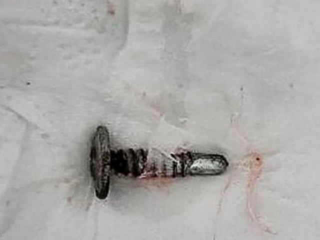 Tin tức trong ngày - Nuốt phải đinh vít trong lớp học, cháu bé 3 tuổi tử vong