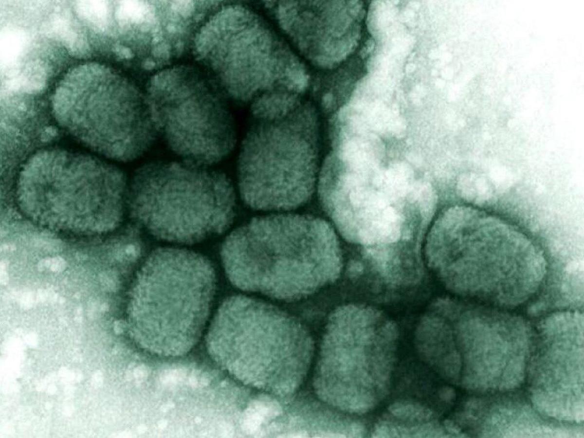 Virus gây bệnh đậu mùa trên kính hiển vi (ảnh: SCMP)