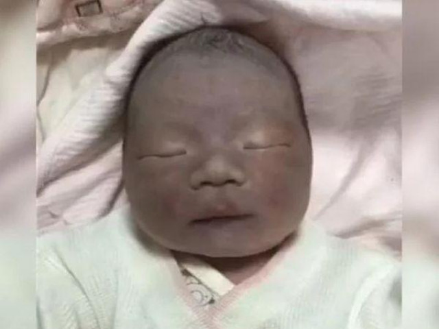 Bạn trẻ - Cuộc sống - Đứa trẻ sinh ra đen như Bao Công khiến bố tưởng trao nhầm, 2 tháng sau bé thay đổi gây sốc