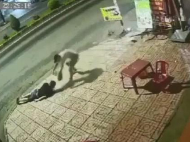 Pháp luật - Kinh hãi nam thanh niên bị kẻ tâm thần tông xe bất tỉnh, tạt nước sôi