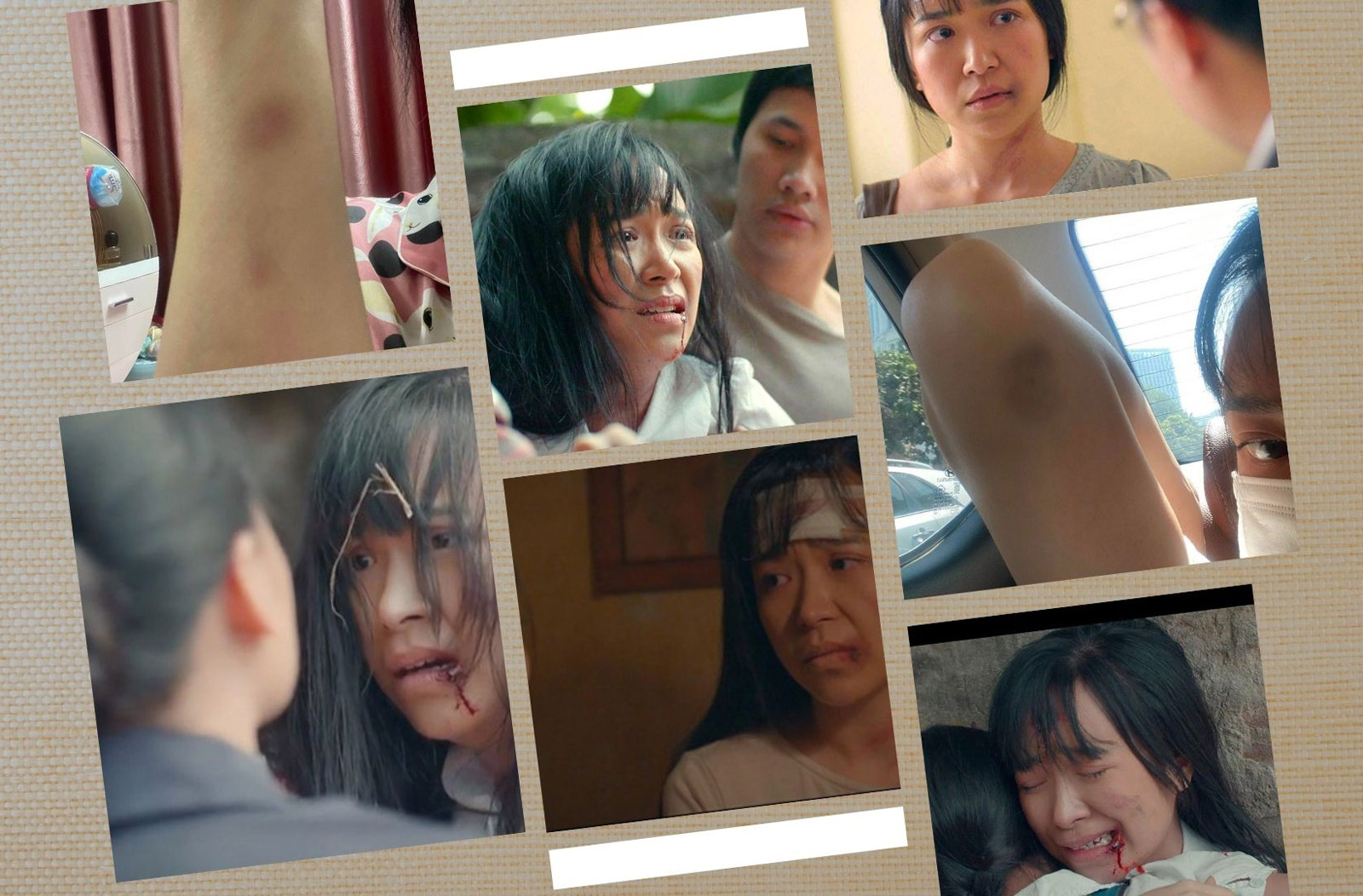 Bầm dập vì cảnh phim bị đánh ghen, cô gái Quảng Trị hé lộ sự thật bất ngờ - 2
