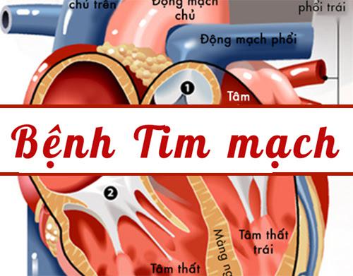 7 yếu tố nguy cơ gây bệnh tim mạch có thể phòng tránh được - 1