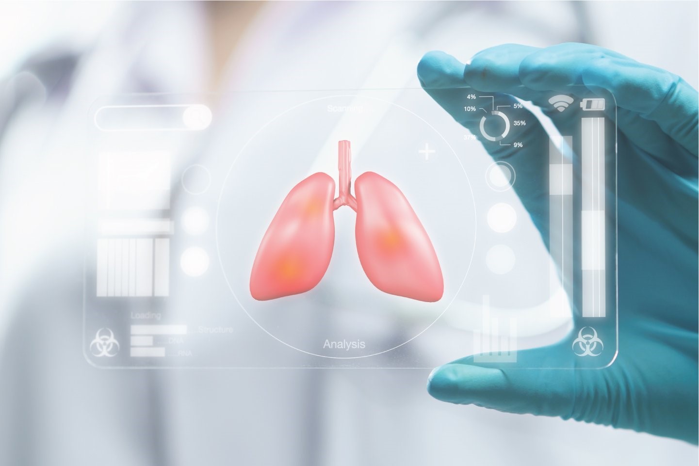 Fucoidan hỗ trợ tăng cường miễn dịch cho người ung thư phổi