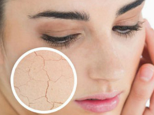 Làm đẹp - Da khô nên bổ sung vitamin và khoáng chất gì?