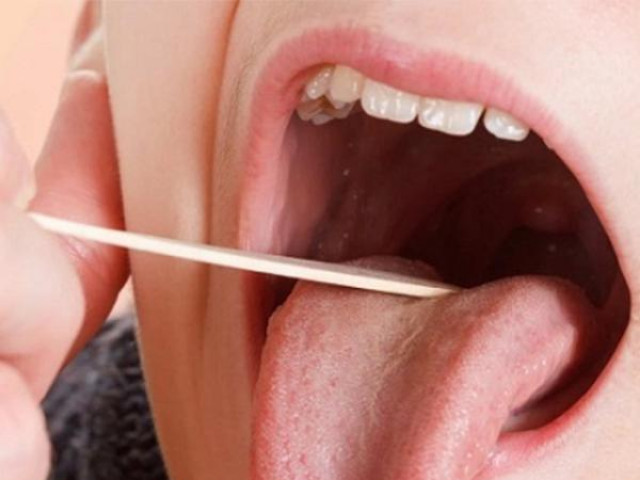 Sức khỏe đời sống - 11 dấu hiệu trên lưỡi cảnh báo bệnh