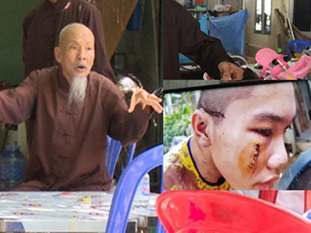 Đời sống Showbiz - Bị ném gạch vào mặt, phía “Tịnh thất Bồng lai” sắp ra tòa, đòi bồi thường 3 tỷ