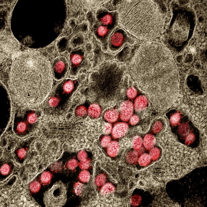 HÌnh ảnh hiển vi cho thấy các hạt virus SARS-CoV-2 dày đặc ở bệnh nhân COVID-19 - Ảnh: NIAD