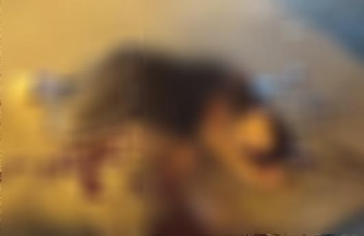 Nạn nhân bị chém lìa bàn tay, nằm bất động trước khi được người dân đưa đi cấp cứu