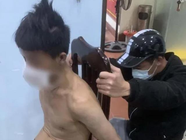 Pháp luật - Thanh niên leo trèo như "người nhện", ném gạch đá vì nghĩ có người đuổi giết mình