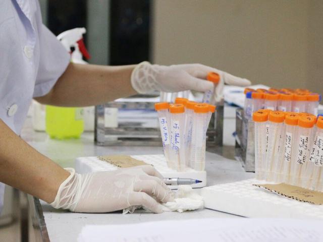 Tin tức trong ngày - 8 cô gái ở cùng nhà trọ tại Đồ Sơn dương tính với SARS-CoV-2