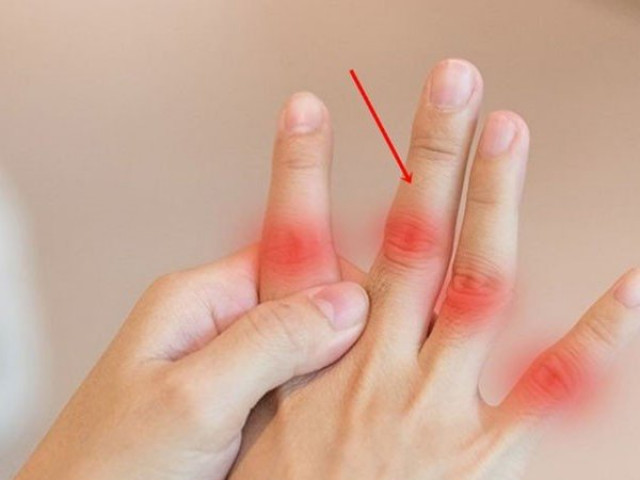 Sức khỏe đời sống - Ngón giữa có 3 dấu hiệu này cẩn thận gan có vấn đề, nên đi khám ngay