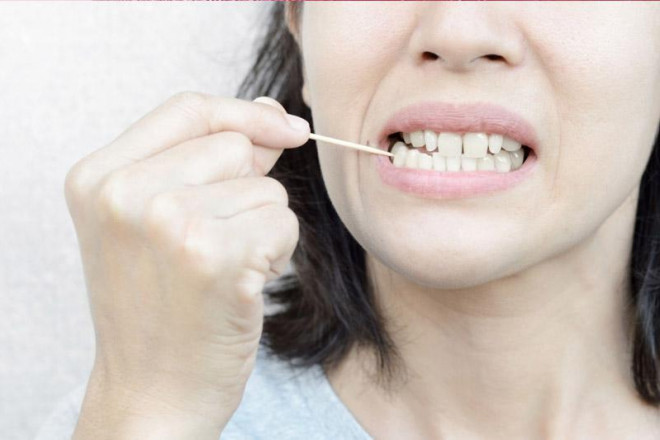 5 thói quen tàn phá răng lợi của bạn, không muốn hỏng răng sớm cần tránh ngay - 6
