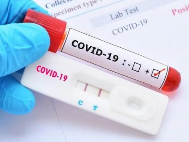 Tin tức trong ngày - Trừ tiền test Covid-19 với giá "cắt cổ", hàng trăm công nhân bức xúc: Doanh nghiệp nói gì?