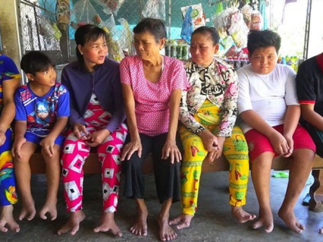 Sức khỏe đời sống - Gia đình 3 thế hệ tay chân chỉ 2- 3 ngón ở miền Tây