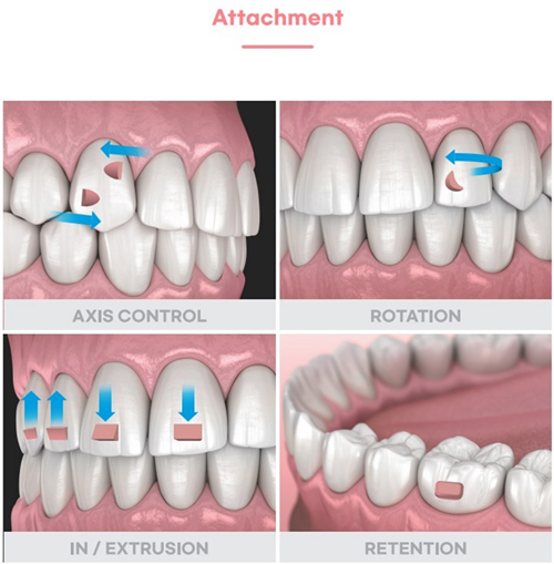 6 Months Smile - cải thiện răng cửa siêu tốc cùng Nha khoa Blossom - 5