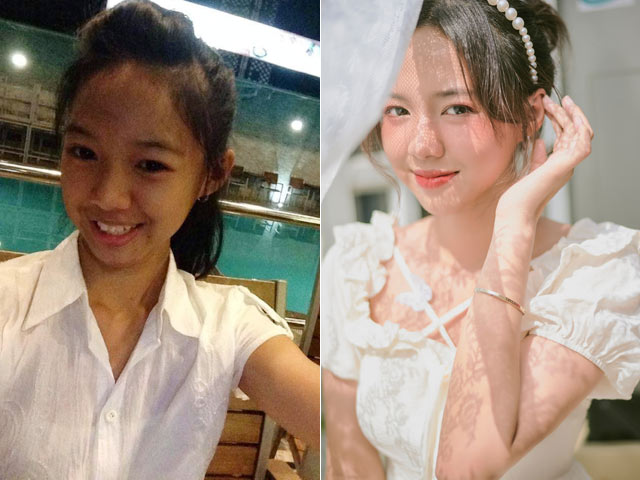 Bạn trẻ - Cuộc sống - Học giỏi vẫn bị bạn bè tẩy chay vì xấu xí, cô gái một bước "biến" thành hot girl xinh đẹp