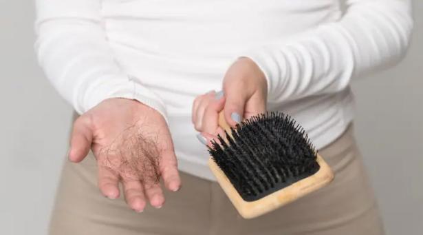 5 cách đối phó với chứng rụng tóc sau sinh - 1