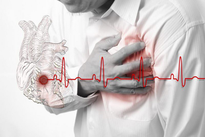 Suy tim: Nhận biết, nguyên nhân, điều trị và đề phòng biến chứng - 3