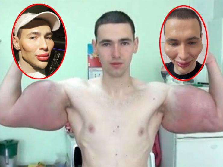 Thể thao - "Lực sĩ Popeye" tay to như đùi Roberto Carlos, thẩm mĩ giống hệt phụ nữ