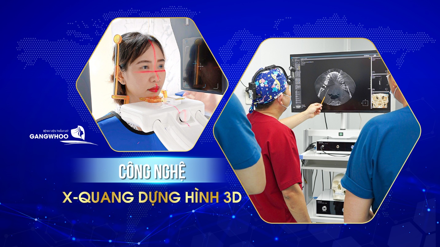 Bệnh viện thẩm mỹ Gangwhoo tung ưu đãi lớn mừng ngày Phụ nữ Việt Nam 2022 - 5