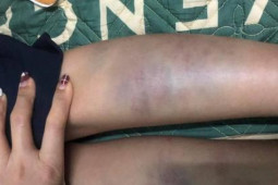 Tin tức trong ngày - NÓNG: Kết luận vụ học sinh ở Đà Nẵng hoảng loạn khi từ trường về nhà