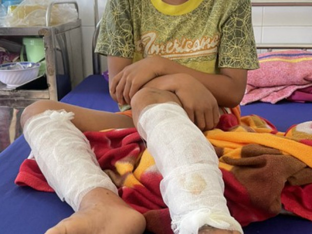 Pháp luật - Một cháu bé 9 tuổi ở Quảng Bình bị người thân dùng xăng và rơm đốt