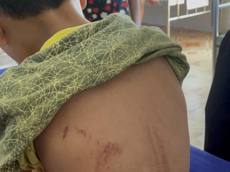 Tin tức trong ngày - Tin tức 24h qua: Lộ lý do bố đốt hai chân con trai 9 tuổi