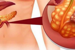 Người đàn ông có huyết tương trắng đục như sữa do thường xuyên nghiện những món khoái khẩu này