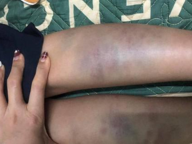 Tin tức trong ngày - Diễn biến mới vụ “học sinh ở Đà Nẵng hoảng loạn khi từ trường về nhà"